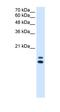 Ubiquitously Expressed Prefoldin Like Chaperone antibody, orb330628, Biorbyt, Western Blot image 
