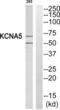 Potassium Voltage-Gated Channel Subfamily A Member 5 antibody, abx014729, Abbexa, Western Blot image 