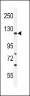 Rho GTPase Activating Protein 30 antibody, 61-747, ProSci, Western Blot image 