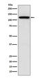 Sortilin 1 antibody, M01666-1, Boster Biological Technology, Western Blot image 