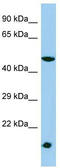 Talin Rod Domain Containing 1 antibody, TA331769, Origene, Western Blot image 