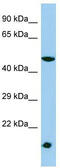 Talin Rod Domain Containing 1 antibody, TA331769, Origene, Western Blot image 