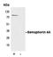 Semaphorin 4A antibody, LS-C353523, Lifespan Biosciences, Immunoprecipitation image 