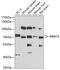 RNA Binding Motif Protein 14 antibody, 19-363, ProSci, Western Blot image 