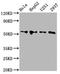 Chaperonin Containing TCP1 Subunit 6A antibody, LS-C680244, Lifespan Biosciences, Western Blot image 