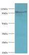 Microcephalin 1 antibody, LS-C378511, Lifespan Biosciences, Western Blot image 