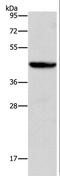 Orosomucoid 2 antibody, LS-B16385, Lifespan Biosciences, Western Blot image 