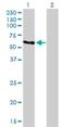 UV excision repair protein RAD23 homolog A antibody, H00005886-M01, Novus Biologicals, Western Blot image 