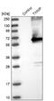 Thioredoxin Interacting Protein antibody, NBP1-84784, Novus Biologicals, Western Blot image 