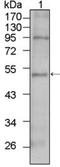 T-box transcription factor TBX5 antibody, NBP1-47450, Novus Biologicals, Western Blot image 