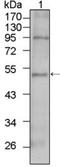 T-Box 5 antibody, NBP1-47450, Novus Biologicals, Western Blot image 