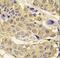 Glutamyl-Prolyl-TRNA Synthetase antibody, LS-C100188, Lifespan Biosciences, Immunohistochemistry frozen image 