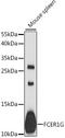 Fc Fragment Of IgE Receptor Ig antibody, LS-C747959, Lifespan Biosciences, Western Blot image 