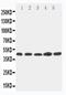 Hepsin antibody, PA5-79392, Invitrogen Antibodies, Western Blot image 