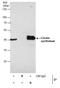 Citrate Synthase antibody, PA5-22126, Invitrogen Antibodies, Immunoprecipitation image 