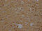 Exportin 1 antibody, CSB-RA930964A0HU, Cusabio, Immunohistochemistry paraffin image 