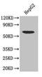 SMAD2 antibody, orb44717, Biorbyt, Western Blot image 