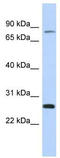 Zinc Finger And SCAN Domain Containing 2 antibody, TA345621, Origene, Western Blot image 