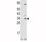 Snail Family Transcriptional Repressor 1 antibody, F47914-0.4ML, NSJ Bioreagents, Western Blot image 
