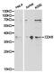 Cyclin Dependent Kinase 6 antibody, TA327072, Origene, Western Blot image 