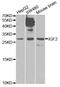 Insulin Like Growth Factor 2 antibody, STJ24139, St John