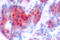 Signal Transducer And Activator Of Transcription 4 antibody, LS-C177956, Lifespan Biosciences, Immunohistochemistry paraffin image 