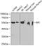 Bactericidal Permeability Increasing Protein antibody, GTX30092, GeneTex, Western Blot image 