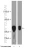 X-Linked Inhibitor Of Apoptosis antibody, 23453-1-AP, Proteintech Group, Western Blot image 