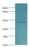 Serpin Family H Member 1 antibody, LS-C376585, Lifespan Biosciences, Western Blot image 