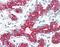 Peroxisomal Biogenesis Factor 7 antibody, orb96603, Biorbyt, Immunohistochemistry paraffin image 