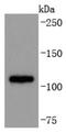 ADAM Metallopeptidase Domain 17 antibody, NBP2-67179, Novus Biologicals, Western Blot image 