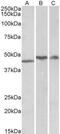 TAR DNA Binding Protein antibody, GTX88503, GeneTex, Western Blot image 