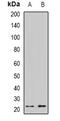 Crystallin Gamma S antibody, abx141438, Abbexa, Western Blot image 