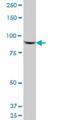 Vav Guanine Nucleotide Exchange Factor 1 antibody, H00007409-M03, Novus Biologicals, Western Blot image 