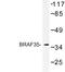 High Mobility Group 20B antibody, LS-C176838, Lifespan Biosciences, Western Blot image 