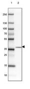 Delta Like Non-Canonical Notch Ligand 1 antibody, NBP2-33697, Novus Biologicals, Western Blot image 