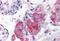 Cell Death Inducing DFFA Like Effector A antibody, MBS240969, MyBioSource, Immunohistochemistry paraffin image 