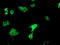 Oxidoreductase NAD Binding Domain Containing 1 antibody, TA503118, Origene, Immunofluorescence image 