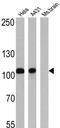 Catenin Alpha 1 antibody, GTX17259, GeneTex, Western Blot image 