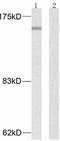 Mitogen-Activated Protein Kinase Kinase Kinase 5 antibody, TA321733, Origene, Western Blot image 