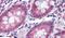 Transmembrane Serine Protease 4 antibody, PA5-34272, Invitrogen Antibodies, Immunohistochemistry paraffin image 