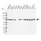 Radixin antibody, VPA00052, Bio-Rad (formerly AbD Serotec) , Western Blot image 