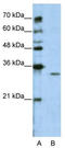 WDVCF antibody, TA346005, Origene, Western Blot image 