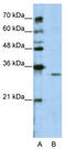 G Protein Subunit Beta 1 Like antibody, TA346005, Origene, Western Blot image 