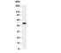 Lipoprotein Lipase antibody, R30361, NSJ Bioreagents, Western Blot image 