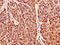 Peroxiredoxin 6 antibody, CSB-PA018659LA01HU, Cusabio, Immunohistochemistry paraffin image 