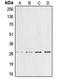 Cyclin G1 antibody, GTX55852, GeneTex, Western Blot image 