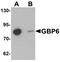 Guanylate Binding Protein Family Member 6 antibody, PA5-72757, Invitrogen Antibodies, Western Blot image 