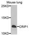 Cysteine Rich Protein 1 antibody, A7548, ABclonal Technology, Western Blot image 