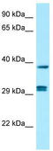 Protein Phosphatase 1 Catalytic Subunit Beta antibody, TA338253, Origene, Western Blot image 